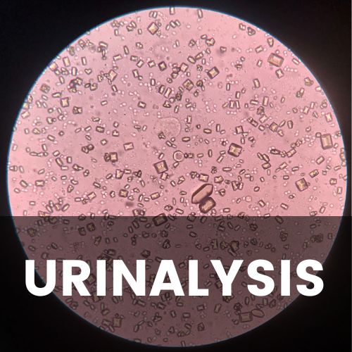 The EFLM Update of the European Urinalysis Guidelines